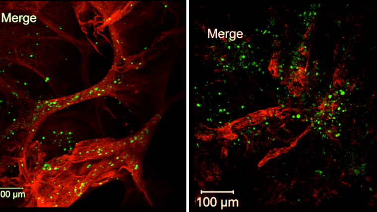Dendritic cells (green) enter dermal lymphatic vessels (red) of normal mice (left) but not  mice missing LYVE-1 (right).