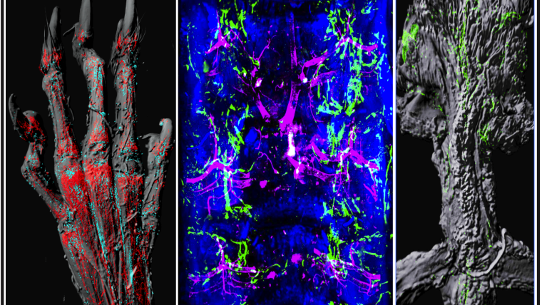 New research from the Kusumbe Group show lymphatic networks in bone, a tissue previously difficult to study. A number of different bones are shown (L-R) hand, vertebral column, sternum. In all images, blood vessels are shown in red/magenta, and lymphatic vessels are shown in green.