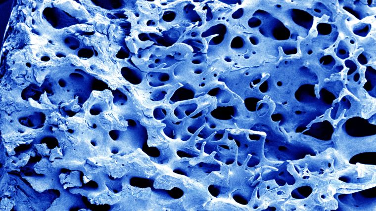 Scanning electron micrograph of bone, computer-coloured blue.