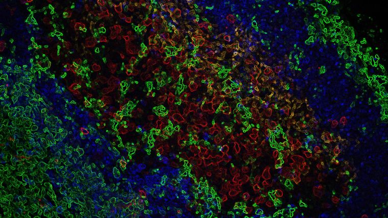 A jazzed-up lymph node germinal centre micrograph, with naive B cells (blue), GC B cells (red), follicular dendritic cells (orange) and macrophages (green).